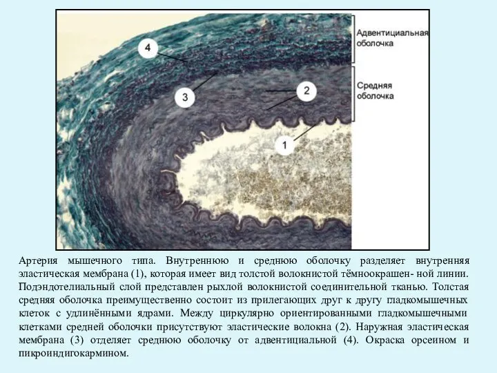 Артерия мышечного типа. Внутреннюю и среднюю оболочку разделяет внутренняя эластическая мембрана (1),