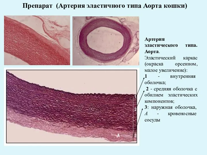 Препарат (Артерия эластичного типа Аорта кошки) Артерия эластического типа. Аорта. Эластический каркас