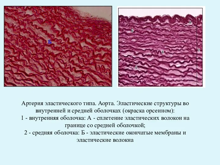 Артерия эластического типа. Аорта. Эластические структуры во внутренней и средней оболочках (окраска