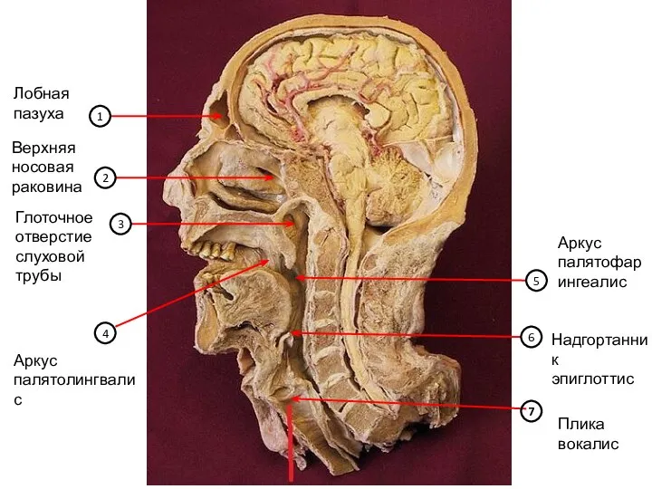 2 3 4 6 5 1 7 Лобная пазуха Верхняя носовая раковина