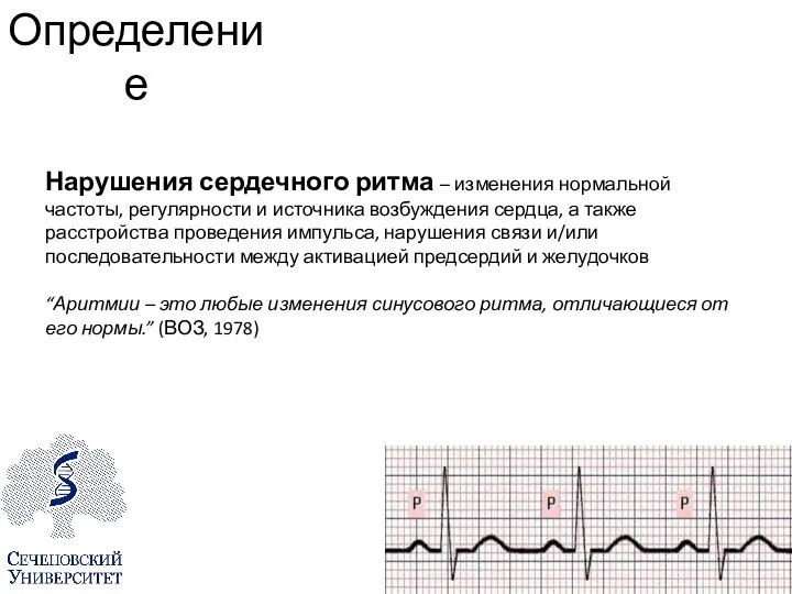 Определение Нарушения сердечного ритма – изменения нормальной частоты, регулярности и источника возбуждения