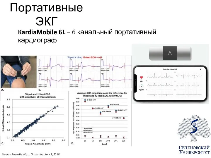 KardiaMobile 6L – 6 канальный портативный кардиограф Stavros Stavrakis и др., Circulation.