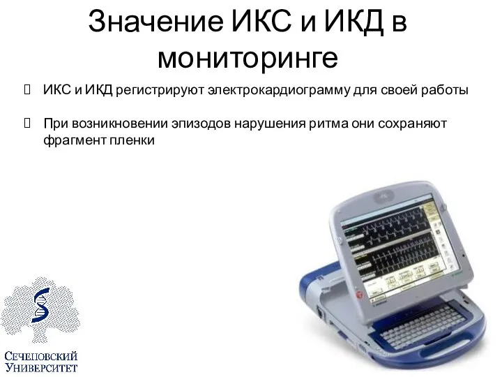 Значение ИКС и ИКД в мониторинге ИКС и ИКД регистрируют электрокардиограмму для