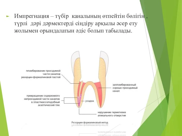 Импрегнация – түбір каналының өтпейтін бөлігін , түрлі дәрі дәрмектерді сіңдіру арқылы