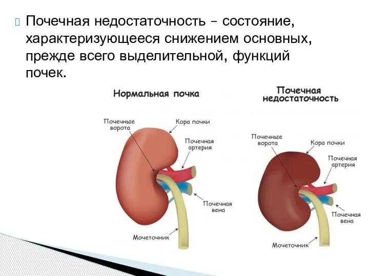 Почечная недостаточность – состояние, характеризующееся снижением основных, прежде всего выделительной, функций почек.