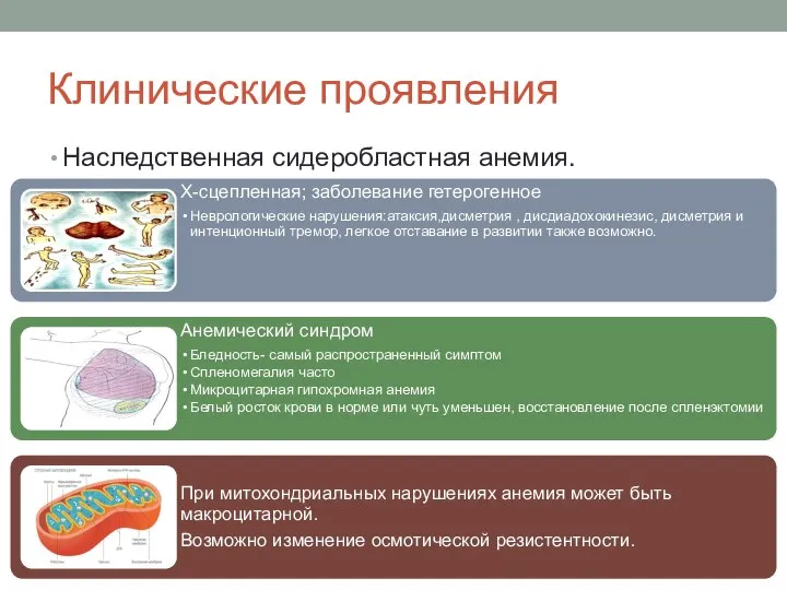 Клинические проявления Наследственная сидеробластная анемия.