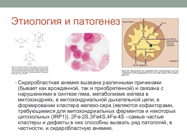 Этиология и патогенез Сидеробластная анемия вызвана различными причинами (бывает как врожденной, так