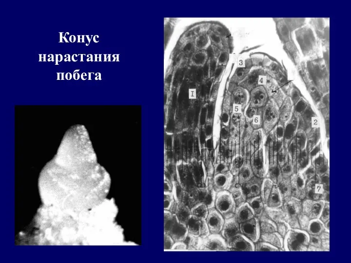 Конус нарастания побега