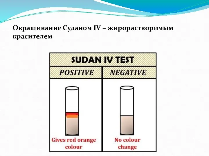 Окрашивание Суданом IV – жирорастворимым красителем