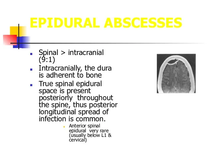 EPIDURAL ABSCESSES Spinal > intracranial (9:1) Intracranially, the dura is adherent to