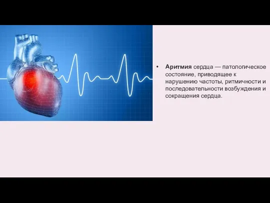 Аритмия сердца — патологическое состояние, приводящее к нарушению частоты, ритмичности и последовательности возбуждения и сокращения сердца.