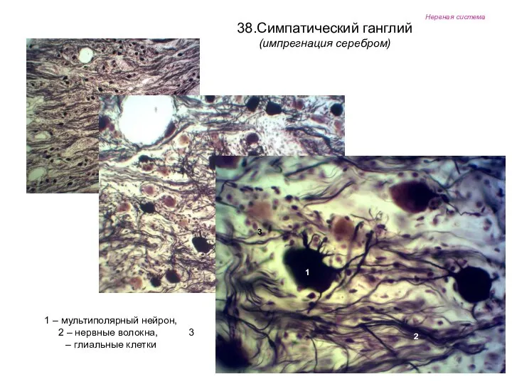 Нервная система