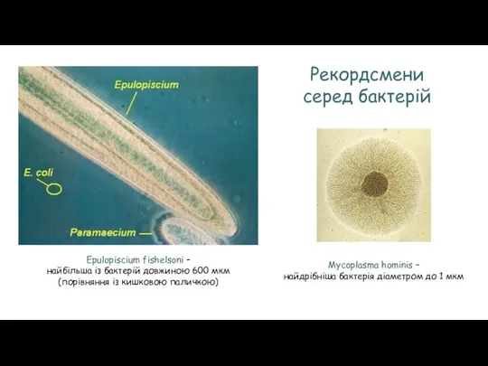 Epulopiscium fishelsoni – найбільша із бактерій довжиною 600 мкм (порівняння із кишковою