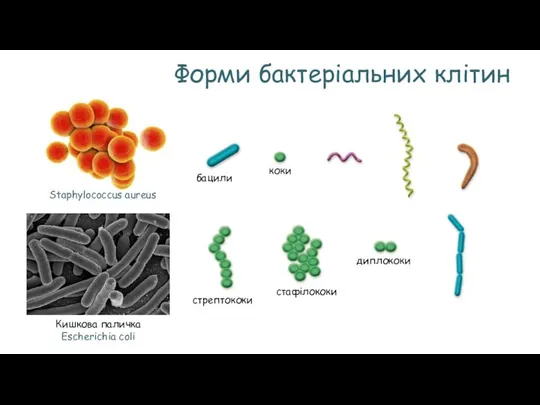 Форми бактеріальних клітин бацили коки стрептококи стафілококи диплококи Staphylococcus aureus Кишкова паличка Escherichia coli