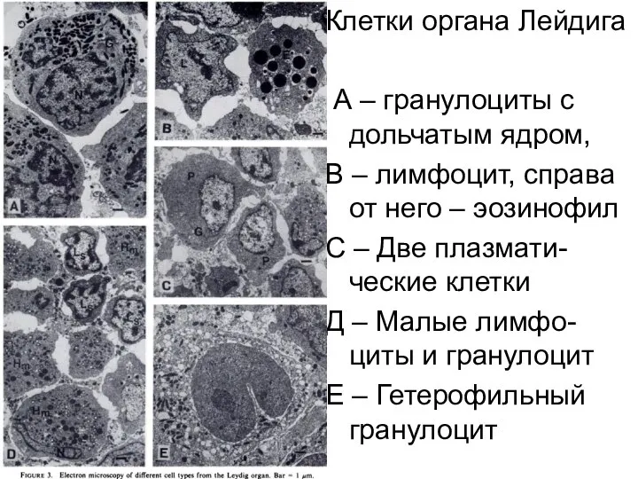 Клетки органа Лейдига А – гранулоциты с дольчатым ядром, В – лимфоцит,