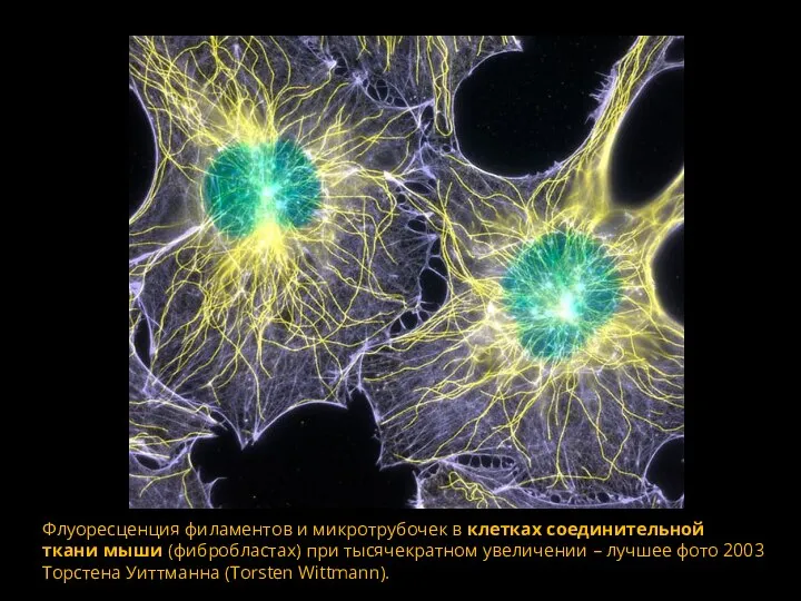 Флуоресценция филаментов и микротрубочек в клетках соединительной ткани мыши (фибробластах) при тысячекратном