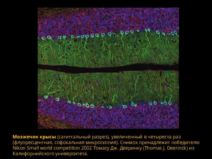 Мозжечок крысы (сагиттальный разрез), увеличенный в четыреста раз (флуоресцентная, софокальная микроскопия). Снимок