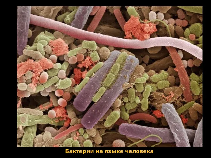 Бактерии на языке человека
