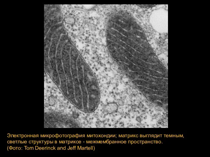 Электронная микрофотография митохондии; матрикс выглядит темным, светлые структуры в матриксе - межмембранное