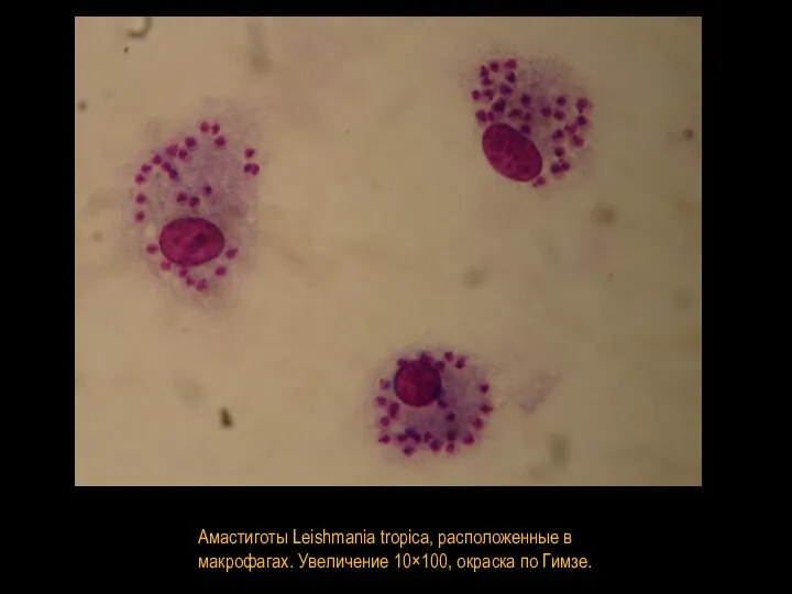 Амастиготы Leishmania tropica, расположенные в макрофагах. Увеличение 10×100, окраска по Гимзе.