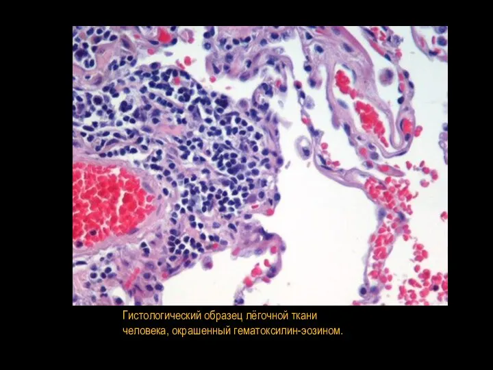 Гистологический образец лёгочной ткани человека, окрашенный гематоксилин-эозином.