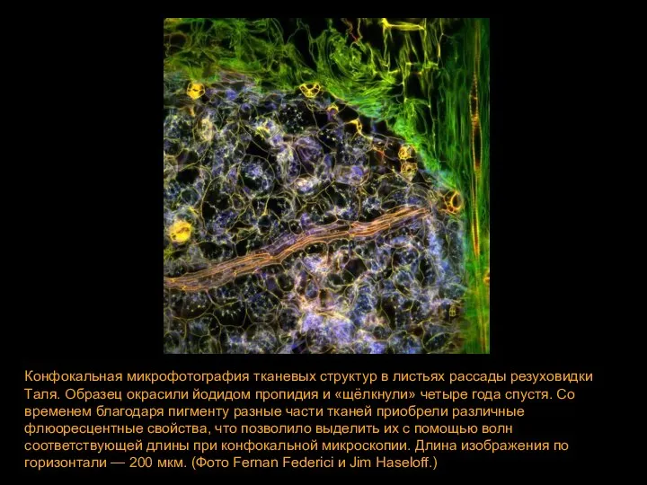 Конфокальная микрофотография тканевых структур в листьях рассады резуховидки Таля. Образец окрасили йодидом