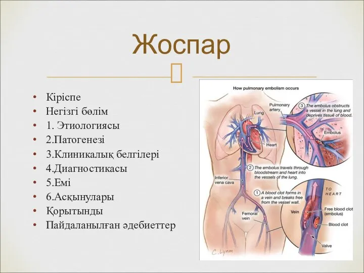 Кіріспе Негізгі бөлім 1. Этиологиясы 2.Патогенезі 3.Клиникалық белгілері 4.Диагностикасы 5.Емі 6.Асқынулары Қорытынды Пайдаланылған әдебиеттер Жоспар