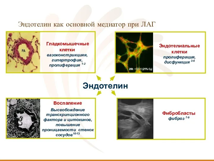 Эндотелин как основной медиатор при ЛАГ Эндотелин