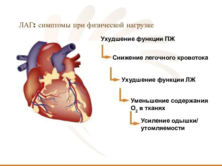 ЛАГ: симптомы при физической нагрузке Ухудшение функции ПЖ Снижение легочного кровотока Ухудшение