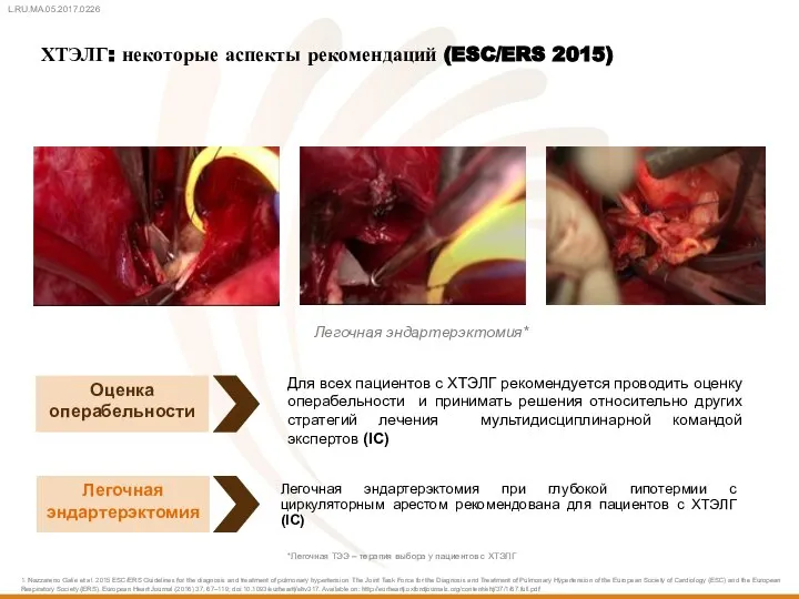 ХТЭЛГ: некоторые аспекты рекомендаций (ESC/ERS 2015) Легочная эндартерэктомия Легочная эндартерэктомия при глубокой