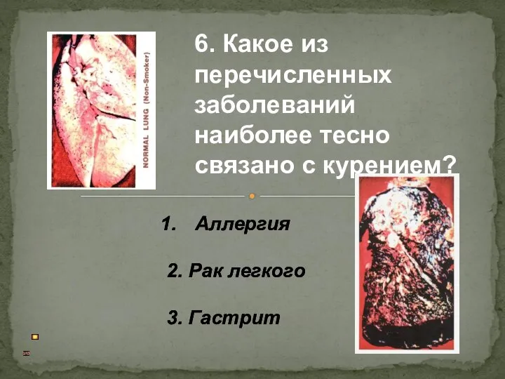 Аллергия 2. Рак легкого 3. Гастрит 6. Какое из перечисленных заболеваний наиболее