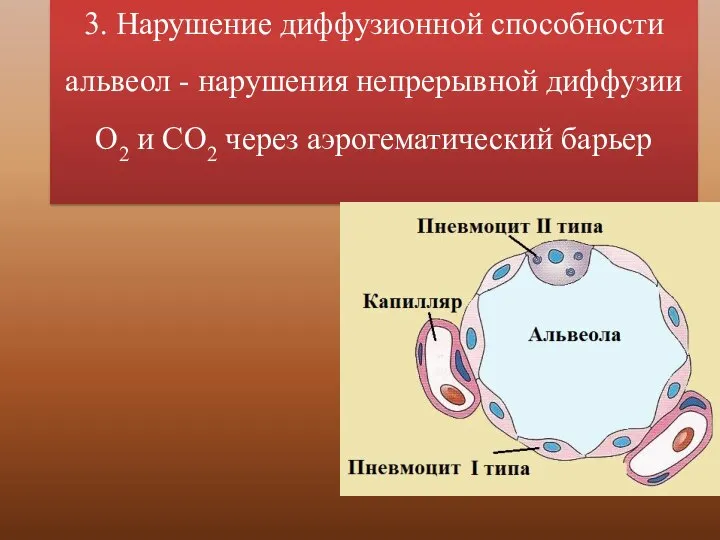 3. Нарушение диффузионной способности альвеол - нарушения непрерывной диффузии О2 и СО2 через аэрогематический барьер
