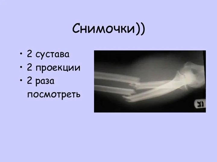 Снимочки)) 2 сустава 2 проекции 2 раза посмотреть