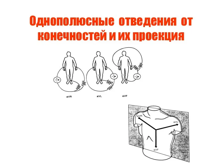 Однополюсные отведения от конечностей и их проекция