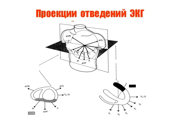 Проекции отведений ЭКГ на 2 плоскости