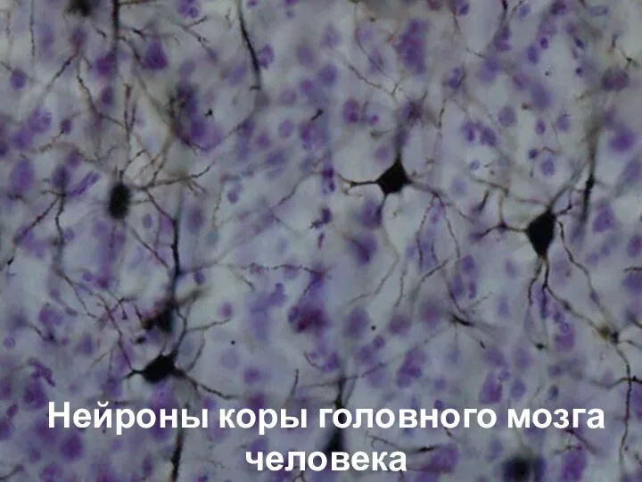 Нейроны коры головного мозга человека