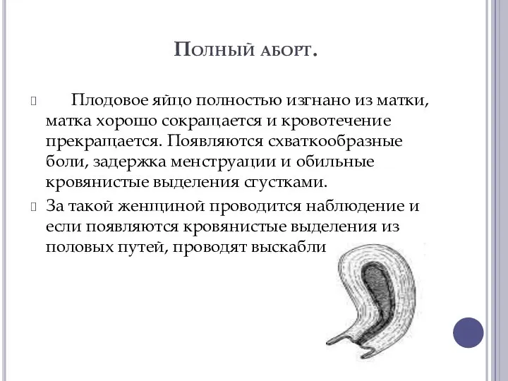 Полный аборт. Плодовое яйцо полностью изгнано из матки, матка хорошо сокращается и