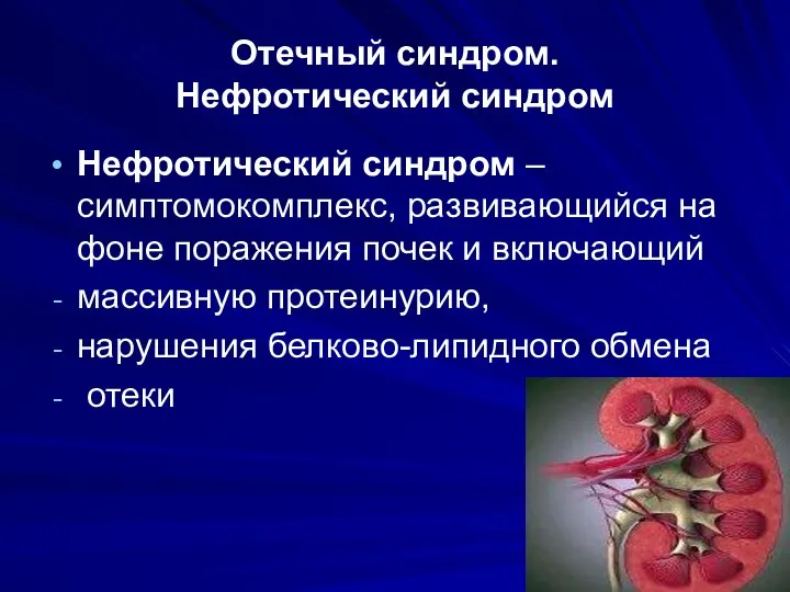 Отечный синдром. Нефротический синдром Нефротический синдром – симптомокомплекс, развивающийся на фоне поражения