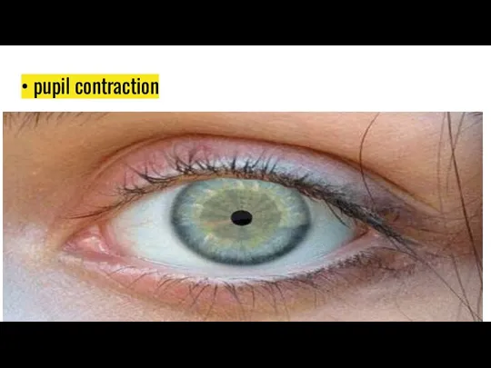 • pupil contraction
