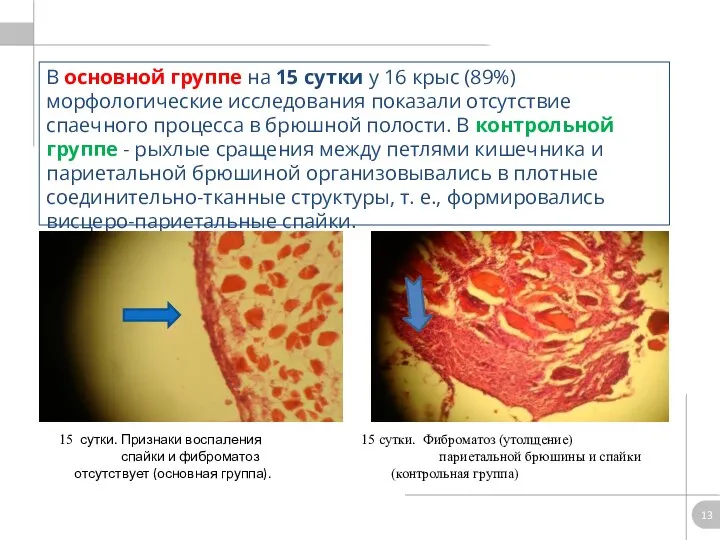 В основной группе на 15 сутки у 16 крыс (89%) морфологические исследования