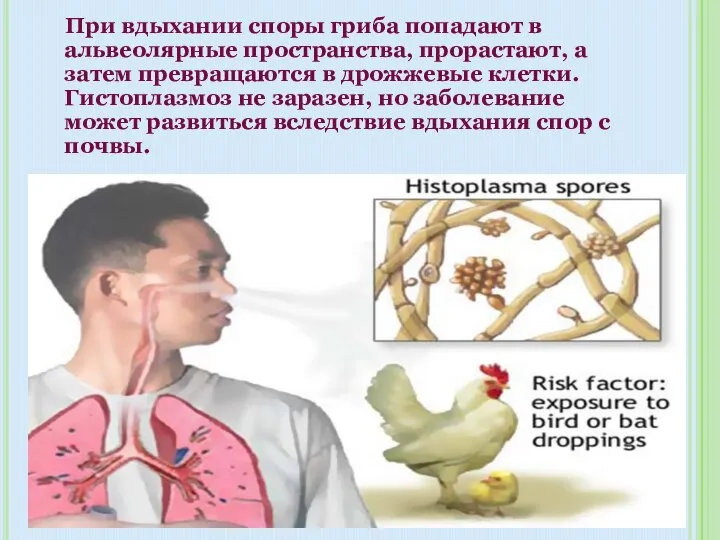 При вдыхании споры гриба попадают в альвеолярные пространства, прорастают, а затем превращаются