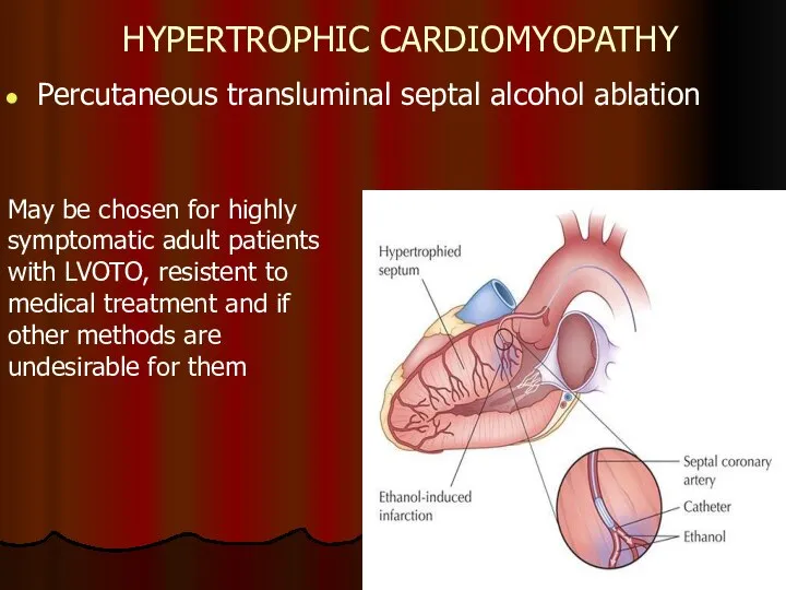 HYPERTROPHIC CARDIOMYOPATHY Percutaneous transluminal septal alcohol ablation May be chosen for highly