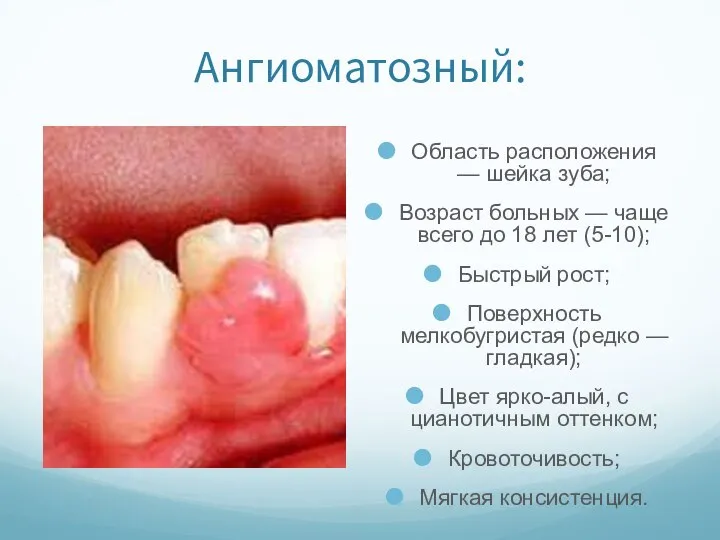 Ангиоматозный: Область расположения — шейка зуба; Возраст больных — чаще всего до