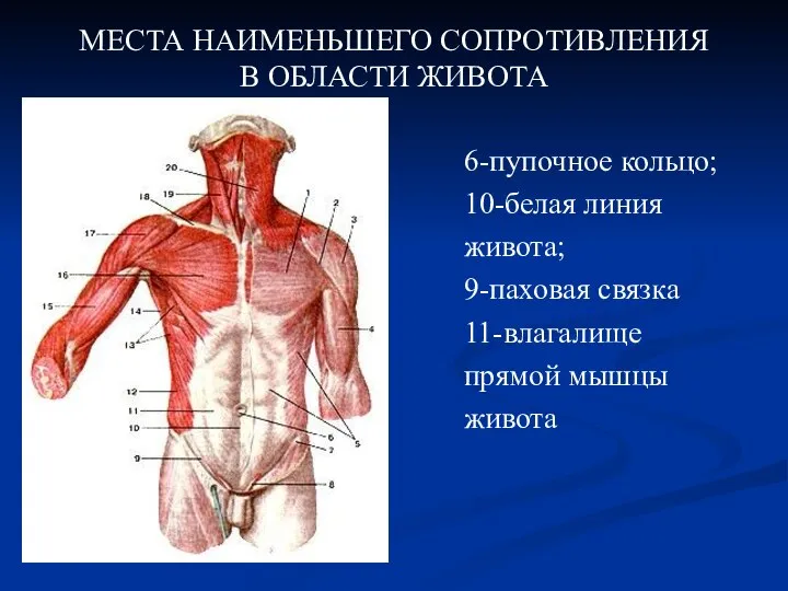 МЕСТА НАИМЕНЬШЕГО СОПРОТИВЛЕНИЯ В ОБЛАСТИ ЖИВОТА 6-пупочное кольцо; 10-белая линия живота; 9-паховая