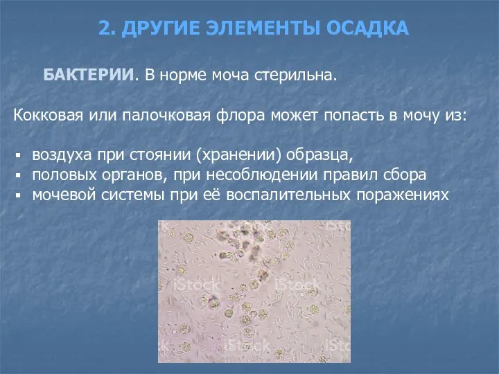 2. ДРУГИЕ ЭЛЕМЕНТЫ ОСАДКА БАКТЕРИИ. В норме моча стерильна. Кокковая или палочковая