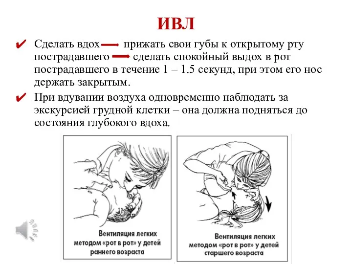 ИВЛ Сделать вдох прижать свои губы к открытому рту пострадавшего сделать спокойный