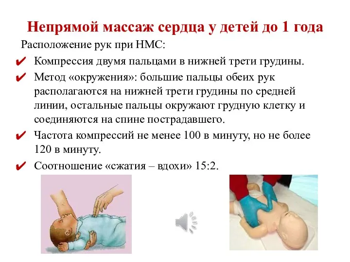 Непрямой массаж сердца у детей до 1 года Расположение рук при НМС: