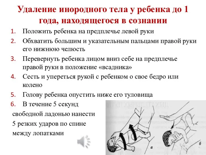 Удаление инородного тела у ребенка до 1 года, находящегося в сознании Положить