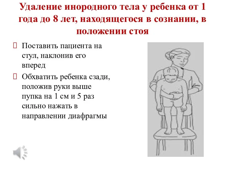 Удаление инородного тела у ребенка от 1 года до 8 лет, находящегося