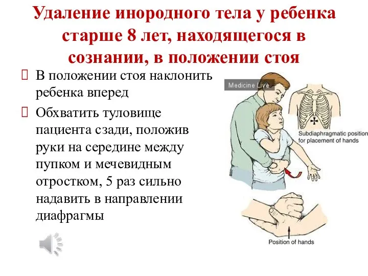 Удаление инородного тела у ребенка старше 8 лет, находящегося в сознании, в